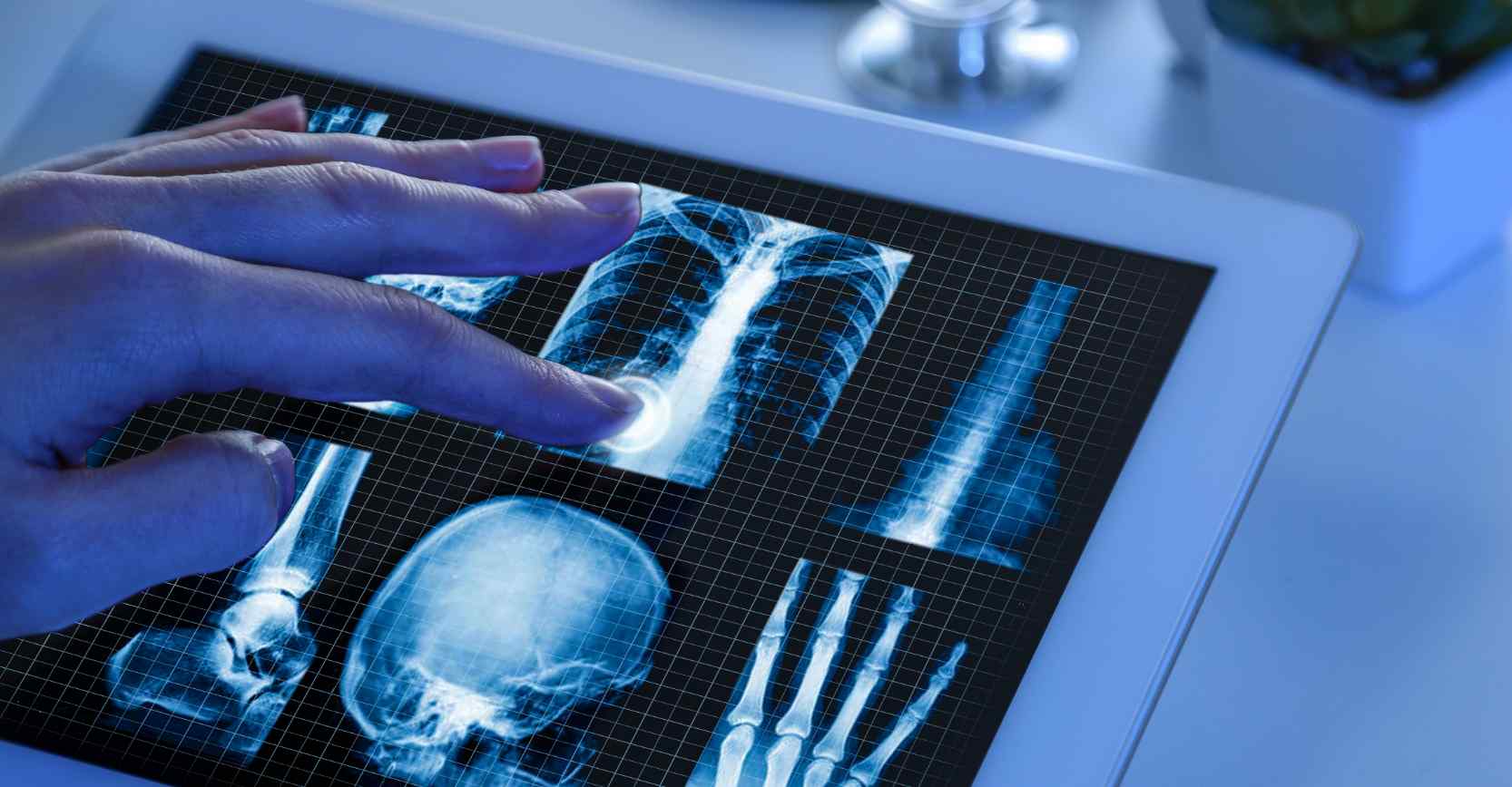xray machine