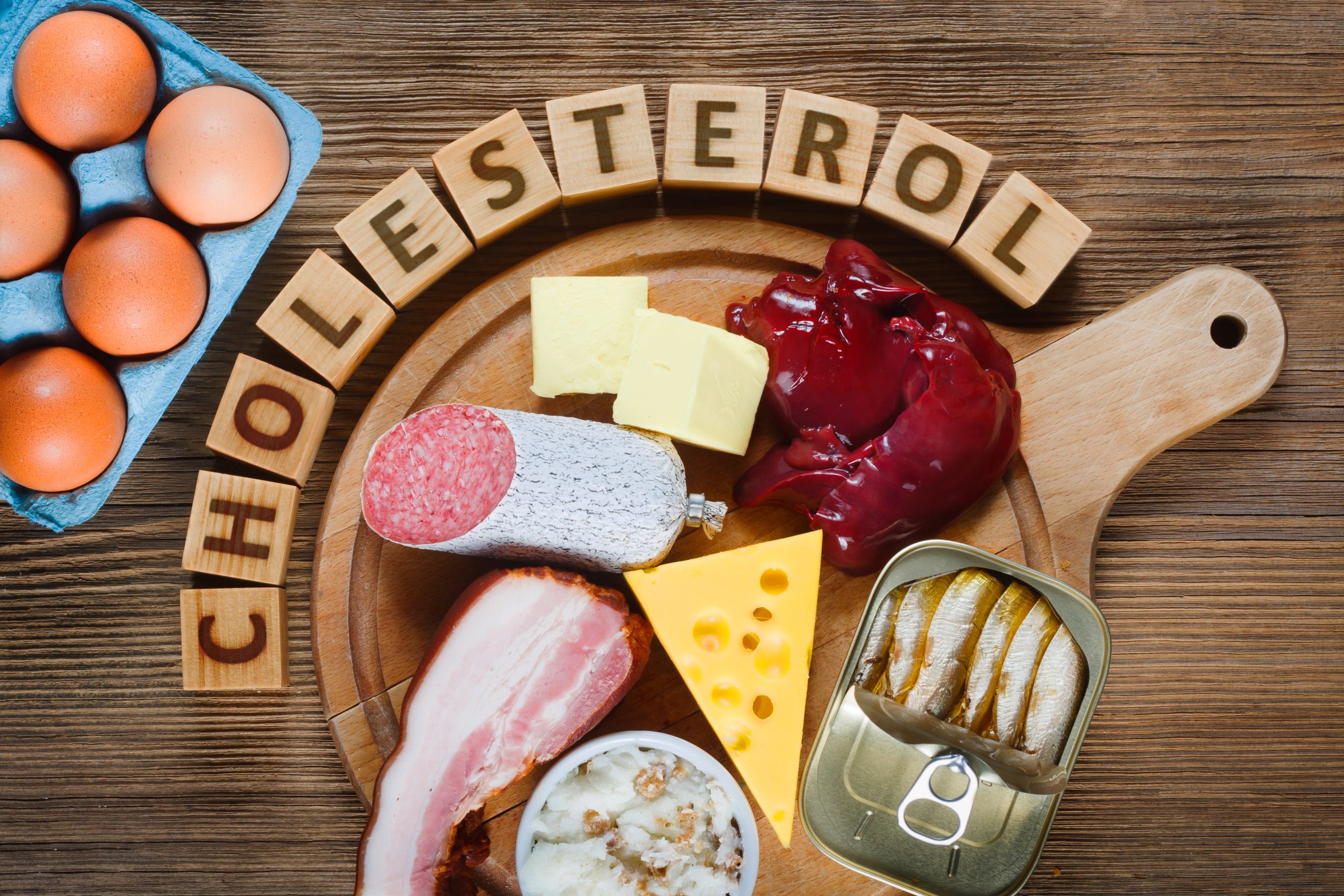 High cholesterol