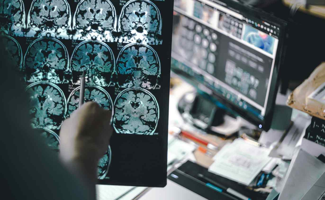 Brain Scan